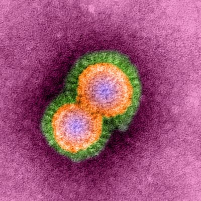 ¿Se puede crear un virus biológico en un laboratorio?