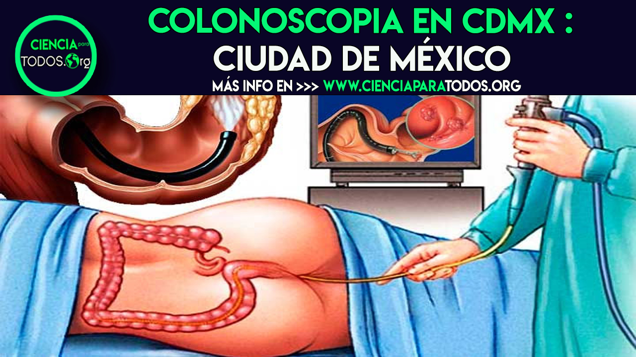 COLONOSCOPIA EN CDMX : CIUDAD DE MÉXICO